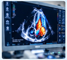 Ecocardiograma Doppler en monitor